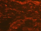 Mouse Skin Vimentin Immunofluorescence Staining