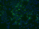 Mouse Keratinocyte Caspase 3 Immunofluorescence Staining