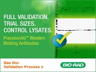 Validated Western Blotting Antibodies That Work Every Time