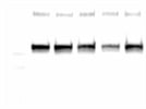 Good Antibody for Phoshp-SRC