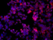 A Powerful Inverted Fluorescent Microscope for Any Task