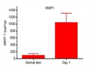 Mouse Skin Wound MMP-1