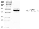 IL-2 Receptor Antibody