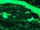 Active Caspase 3 in Mouse Skin