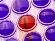 Assay Development: DIY or Use a Custom Service?