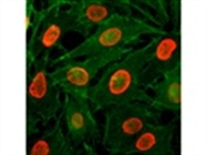 Anti-Acetyl-Histone H3 Rabbit Monoclonal Antibodies