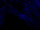 HLA-DR Expression by Human Fibroblasts Treated with INFg