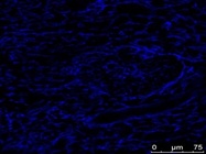 Good Antibody to Detect Stromal Cells