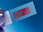 Screening Needs Translated with Protein Microarrays