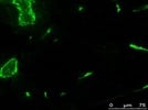 Good Antibody to Boost the GFP Signal