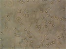 Macrophage Differentiation Using M-CSF