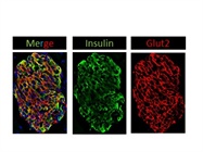 Glut2 Staining in Pancreatic Cryosection