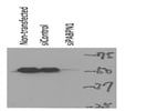 PABPN1 Antibody from Bethyl Laboratories