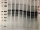 Anti-Hif-2a Antibody from Boster Bio