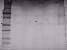 Western blot of CHOP as a measure of ER stress