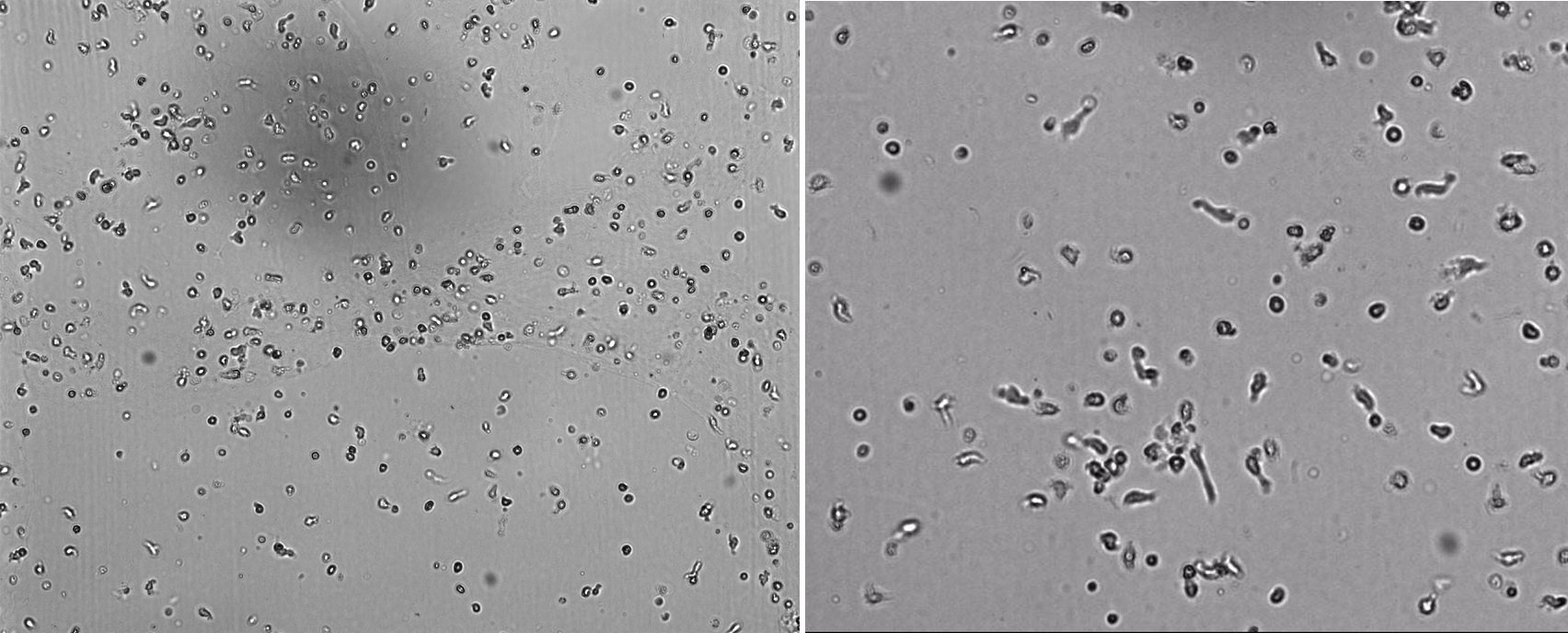 Adherent Cells Vs Suspension Cells