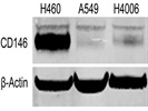 Fluorescent Secondary Antibodies from Li-Cor Simplify Western Blot Quantification