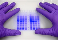 Innovating Detection and Workflow on the Western Blot