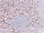 Optimal Antibodies for Immunohistochemistry