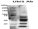 Detection of Ubiquitination by Western Blot