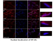 In situ Nuclear Localization of NF-kappaB p65 in Lung Microvessels