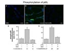 Phosphorylation of p65 in Lung Microvessels