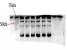 Review of the Anti-GRK5 Antibody (cat#PB9708)