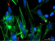 Key Tips on Sample Preparation for Immunofluorescence