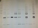 Acetylated Alpha Tubulin