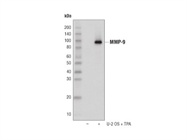 MMP-9 (D6O3H) XP® Rabbit mAb Antibody