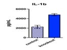 Mouse IL-1 beta/IL-1F2 DuoSet ELISA