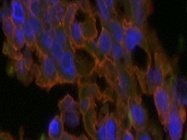 Estrogen Receptor Antibody that Works Very Well for Mouse Xenografts