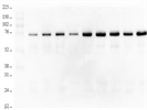 Heat-Shock Protein 90 Beta