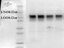 HDAC7 Antibody Review