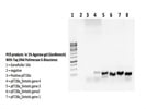 Taq Polymerase Recombinant