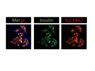 SLC18A2 Staining in Human Pancreas Tissue