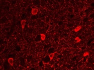 Excellent Rabbit anti-Parvalbumin Antibody for Immunohistochemical Staining of Mouse Brain Slices