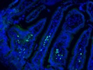 Staining of Mouse Colorectal Tumor Tissue