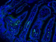 Staining of Mouse Colorectal Tumor Tissue