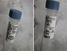 A Reliable Antibody for P-S6 (240/244) Expression Detection