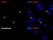 HIF1a in Immunocytochemistry