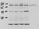 Good Antibody for Immunodetection of Phospho-LATS1 (Ser909) in Mouse Cells
