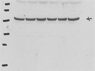 Excellent Antibody for Immunodetection of ß-Tubulin in Mammalian Cells