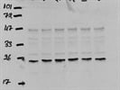 Poor Cell Signaling Technology antibody for Immunodetection of Caspase-1