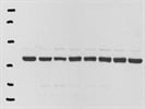 Excellent Cyclin D1 antibody for Immunodetection in human cell