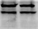 ASC Antibody for Immunocytochemistry