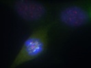 Good Antibody Against Bub1