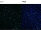 Human Anti-Ki67 Antibody
