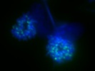 H3S26 Antibody Works Great for IF