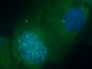 Good Antibody Against Phospho H2A.X
